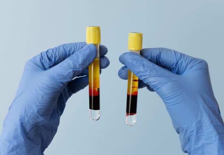 prp which comes well to ills